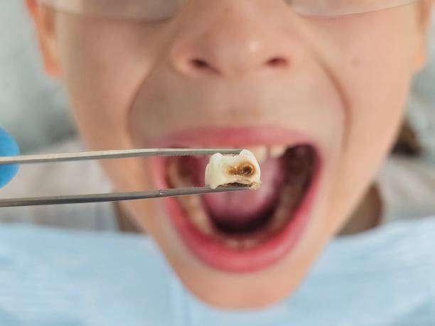 Best Emergency Cosmetic Dentistry (e.g., broken veneers) in North Lewisburg, OH